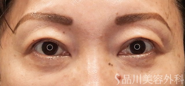 症例NO.73131のAFTER写真