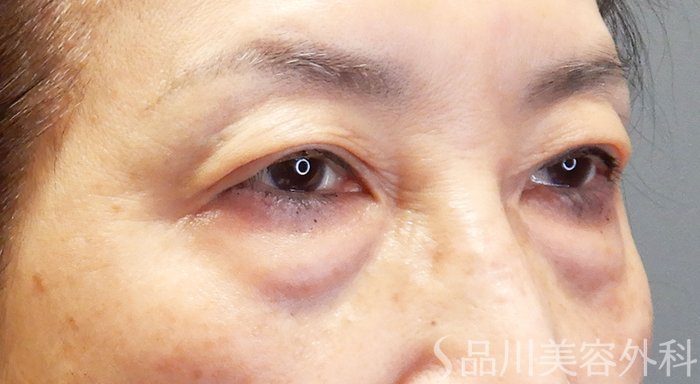 症例NO.69897のBEFORE写真