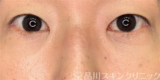 症例NO.61027のAFTER写真