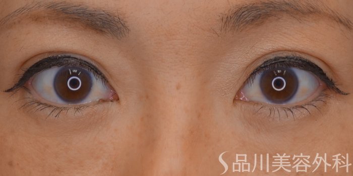 症例NO.65253のAFTER写真