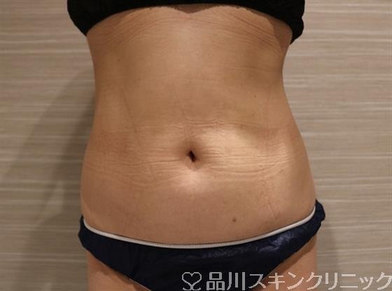 症例NO.42188のAFTER写真
