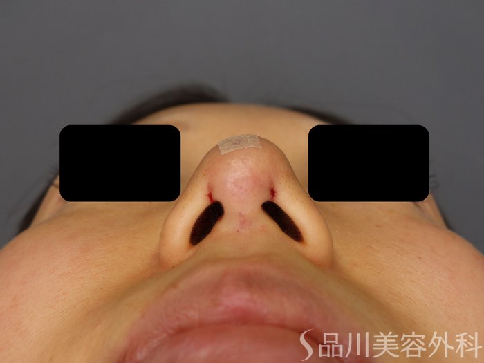 症例NO.73759のAFTER写真