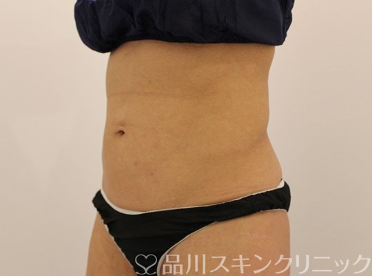 症例NO.73365のBEFORE写真