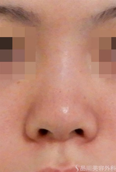 症例NO.38736のBEFORE写真