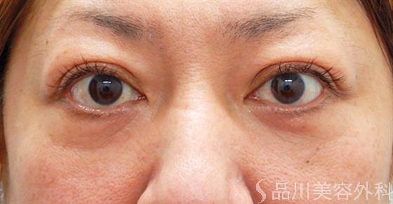 症例NO.53009のAFTER写真