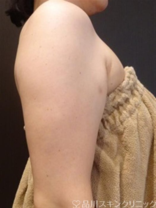 症例NO.33288のBEFORE写真