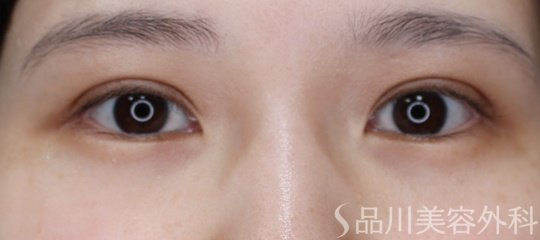 症例NO.67638のAFTER写真