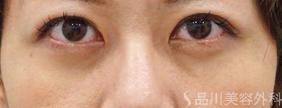 症例NO.49697のAFTER写真