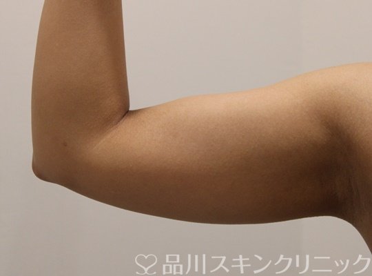 症例NO.67596のBEFORE写真
