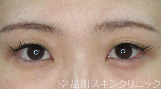 症例NO.72028のBEFORE写真