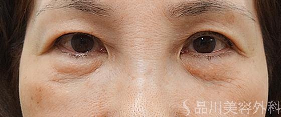 症例NO.32073のBEFORE写真