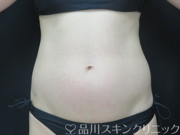 症例NO.70144のBEFORE写真