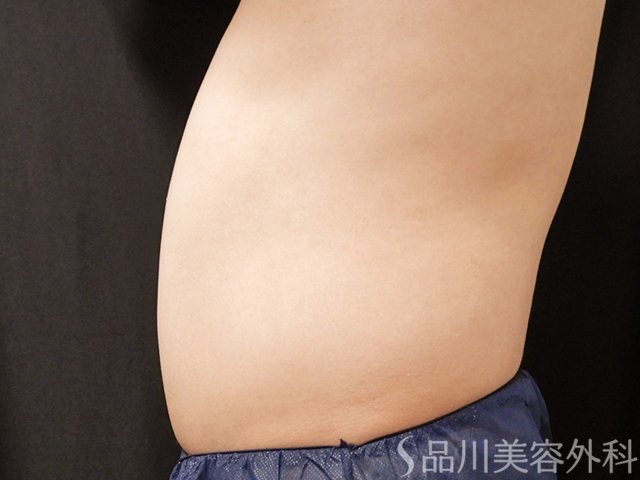 症例NO.73749のBEFORE写真