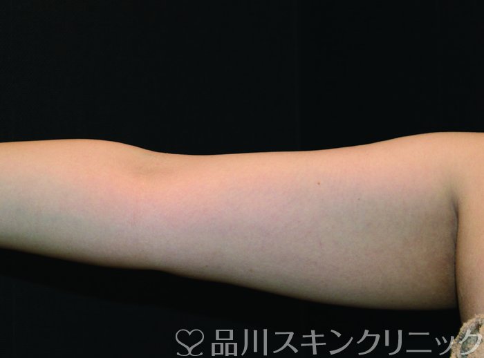 症例NO.73528のBEFORE写真