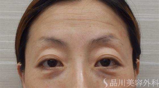 症例NO.16022のBEFORE写真