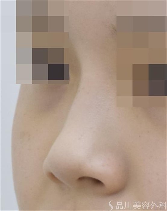 症例NO.47631のBEFORE写真