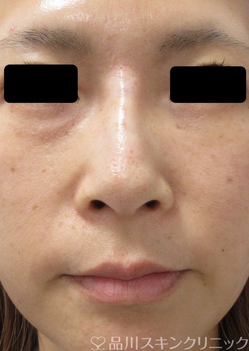 症例NO.73518のAFTER写真