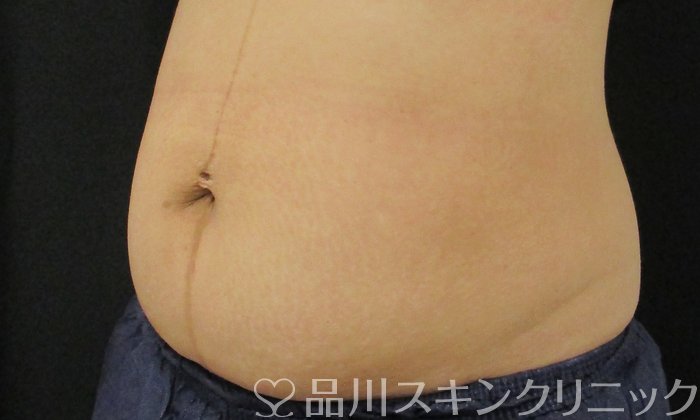 症例NO.74659のBEFORE写真