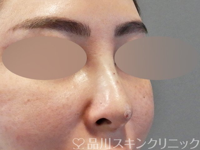 症例NO.67609のAFTER写真