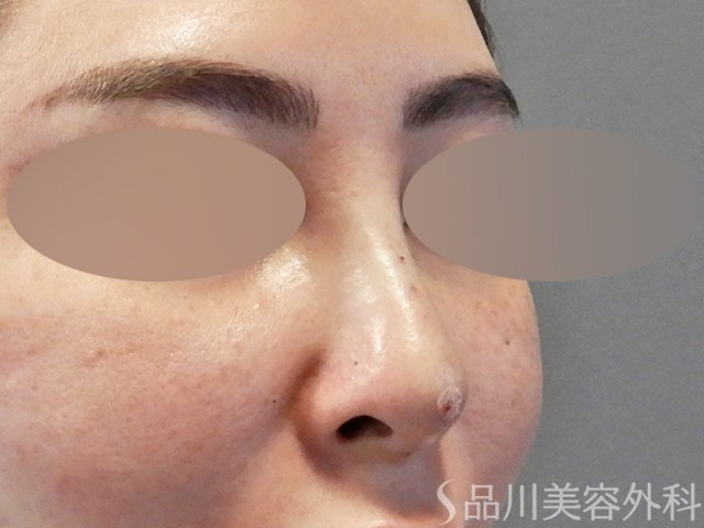 症例NO.67609のAFTER写真