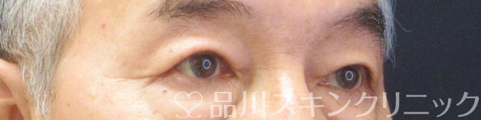 症例NO.63091のAFTER写真