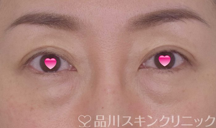 症例NO.65138のBEFORE写真
