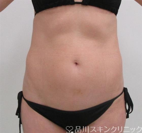 症例NO.36118のBEFORE写真