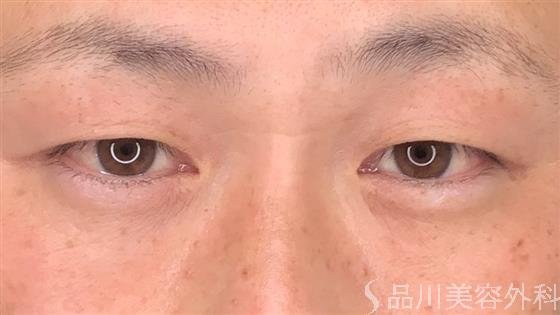 症例NO.59260のBEFORE写真