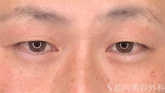 症例NO.59260のBEFORE写真