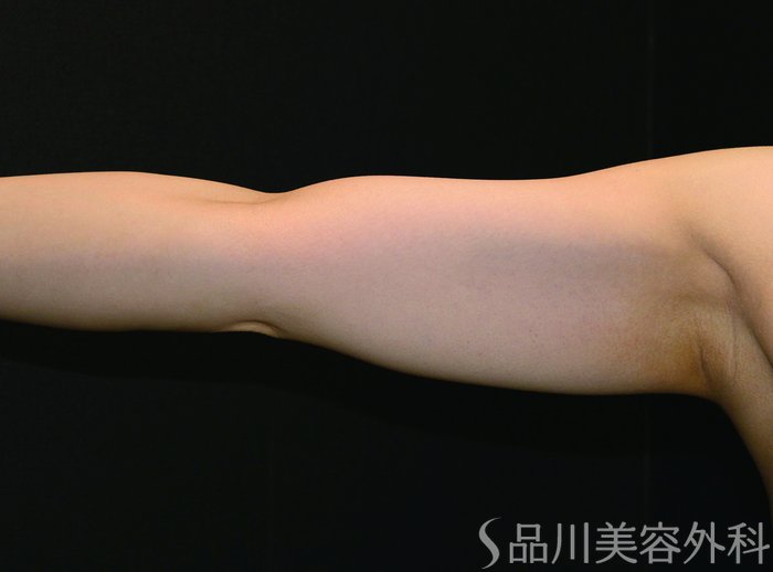 症例NO.65106のBEFORE写真