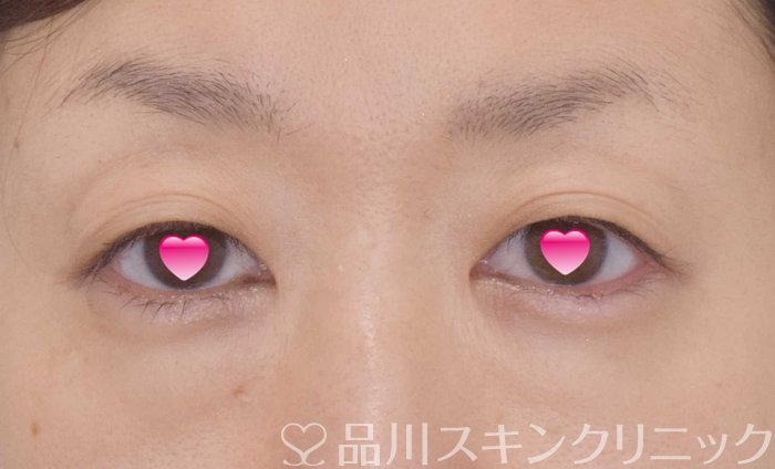症例NO.67796のBEFORE写真