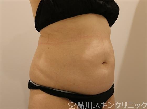 症例NO.42591のBEFORE写真