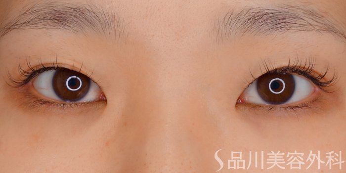 症例NO.70013のBEFORE写真