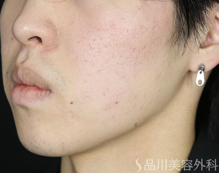 症例NO.73066のBEFORE写真