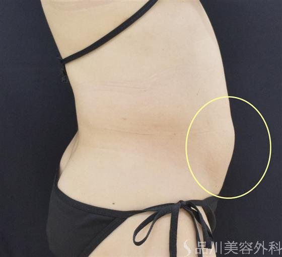 症例NO.50006のBEFORE写真