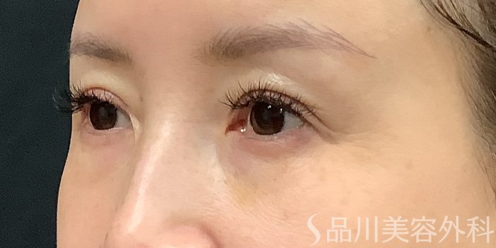 症例NO.71232のBEFORE写真