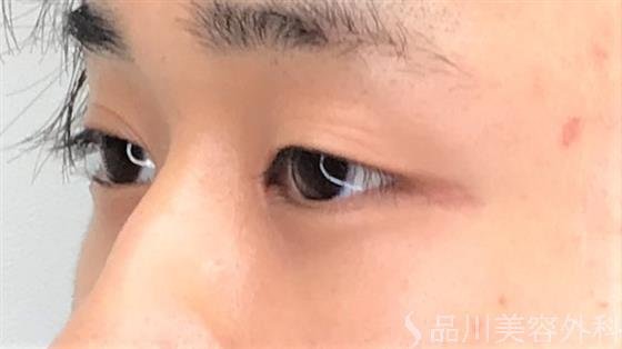 症例NO.59120のBEFORE写真