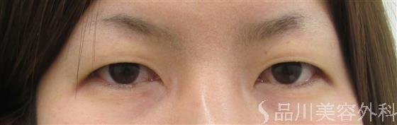 症例NO.40802のBEFORE写真