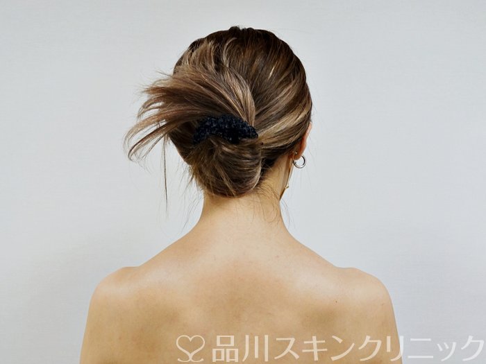 症例NO.73124のBEFORE写真