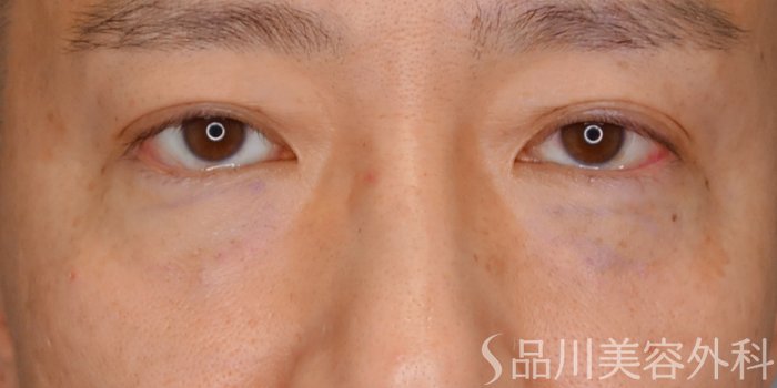 症例NO.73101のAFTER写真