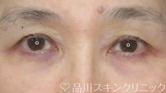 症例NO.63489のBEFORE写真