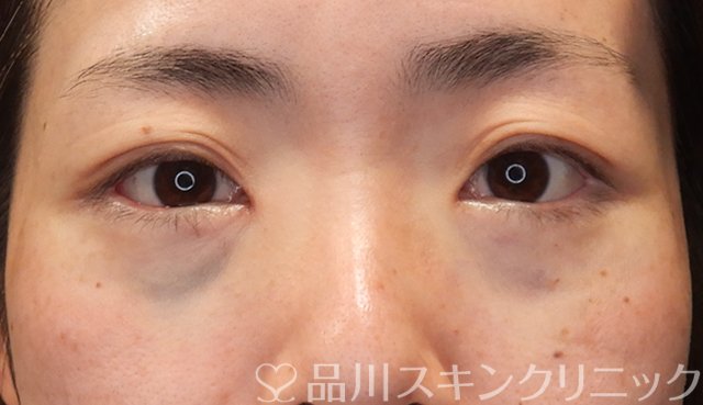 症例NO.68167のAFTER写真