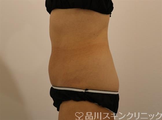 症例NO.43631のBEFORE写真