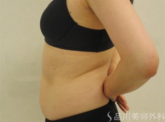 症例NO.49531のBEFORE写真