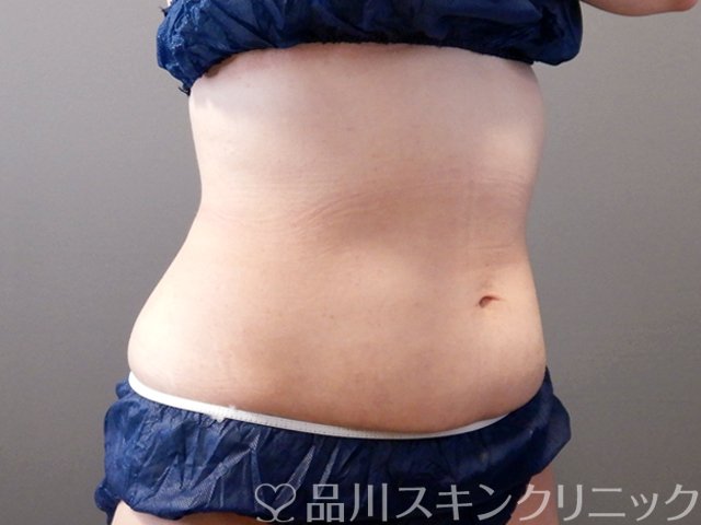 症例NO.67553のBEFORE写真