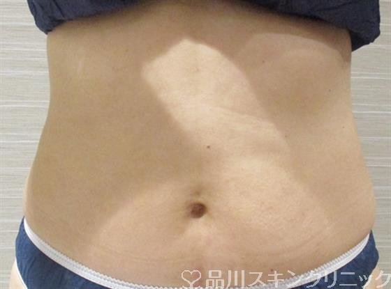 症例NO.36192のAFTER写真