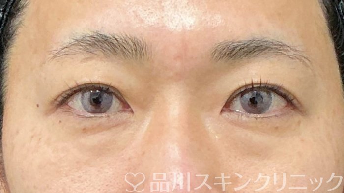 症例NO.73582のBEFORE写真