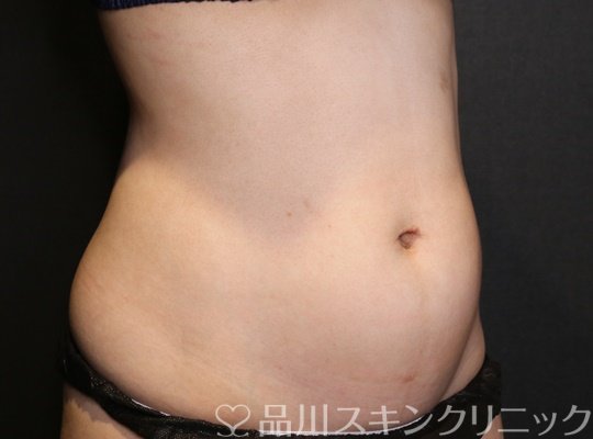 症例NO.70189のBEFORE写真