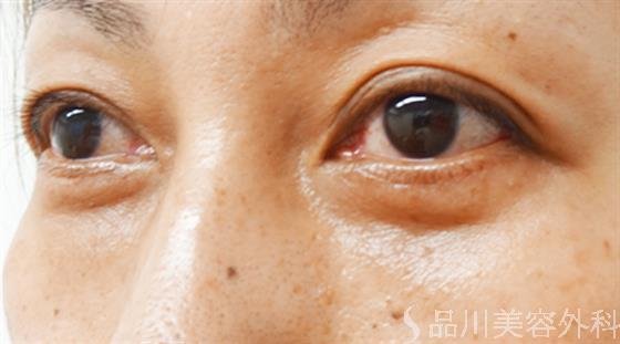 症例NO.27281のAFTER写真
