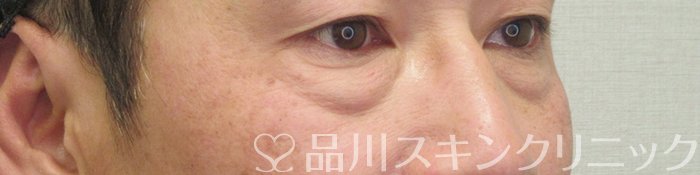 症例NO.73726のBEFORE写真